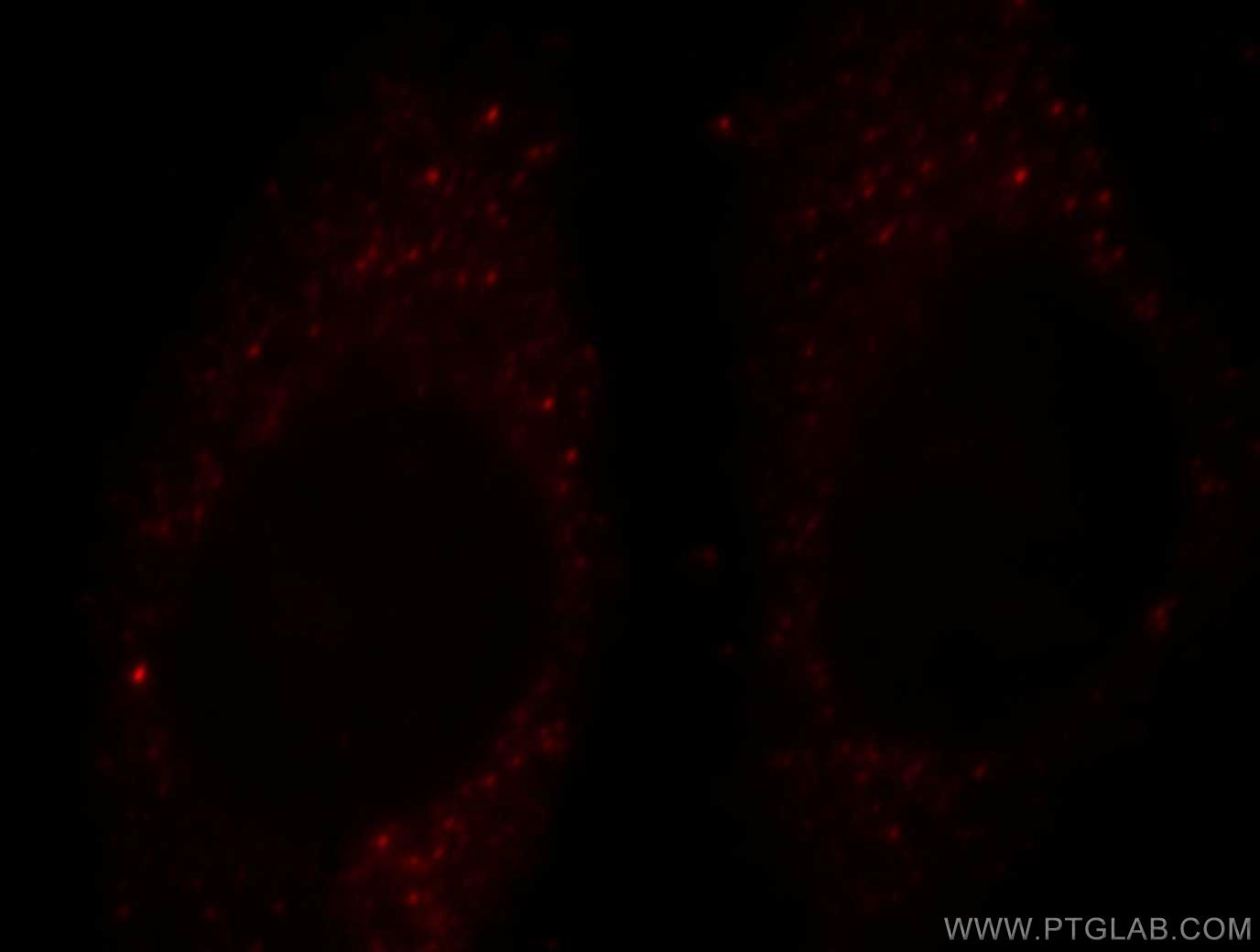 Immunofluorescence (IF) / fluorescent staining of HepG2 cells using FOXO4 Polyclonal antibody (19121-1-AP)