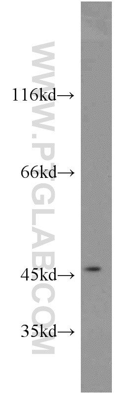 Western Blot (WB) analysis of human heart tissue using FOXO4 Polyclonal antibody (19121-1-AP)