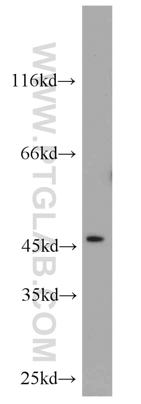 Western Blot (WB) analysis of mouse heart tissue using FOXO4 Polyclonal antibody (19121-1-AP)