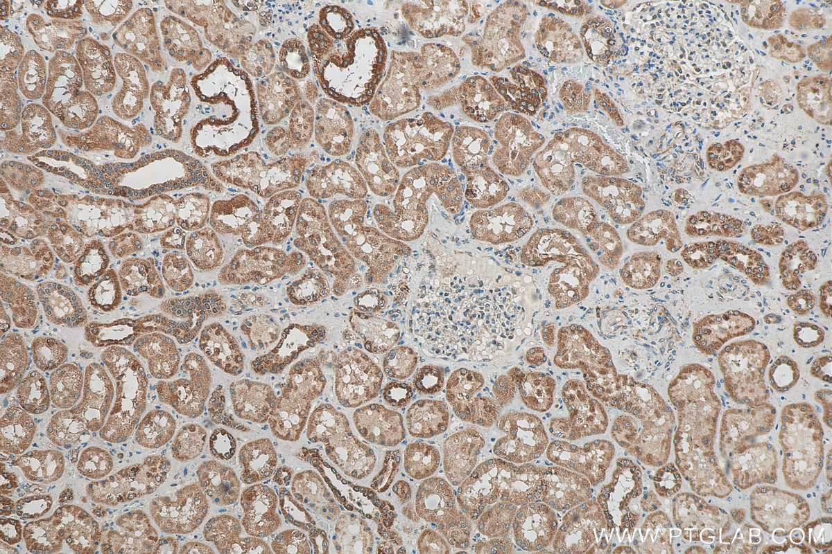 Immunohistochemistry (IHC) staining of human kidney tissue using FOXO4 Polyclonal antibody (21535-1-AP)