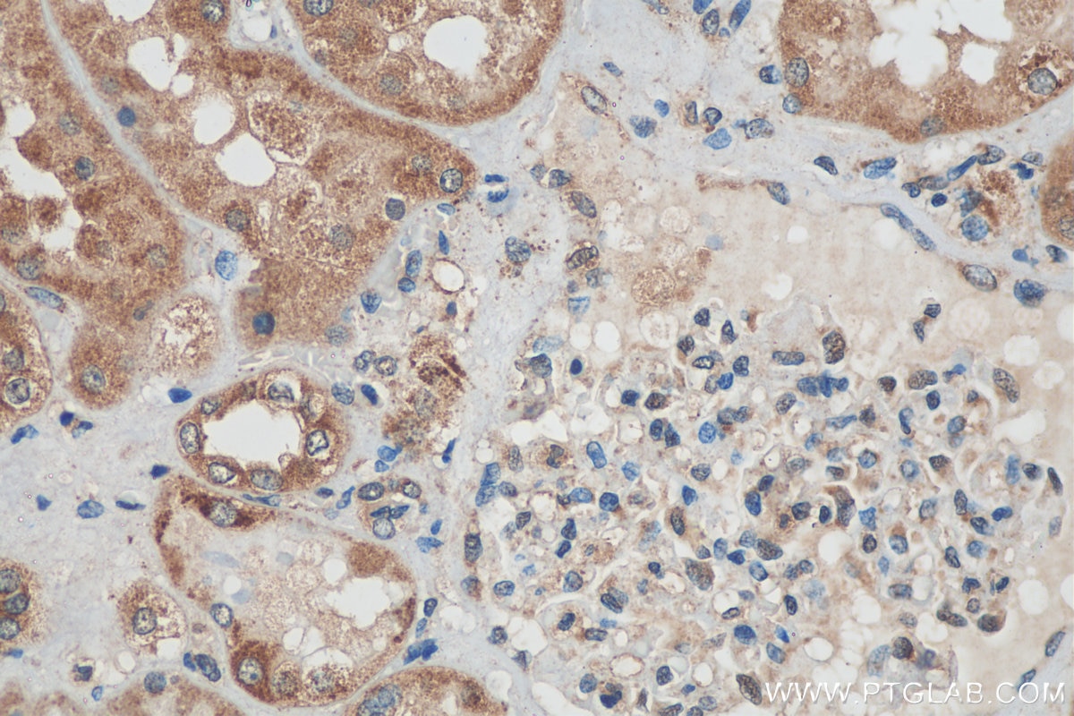 Immunohistochemistry (IHC) staining of human kidney tissue using FOXO4 Polyclonal antibody (21535-1-AP)