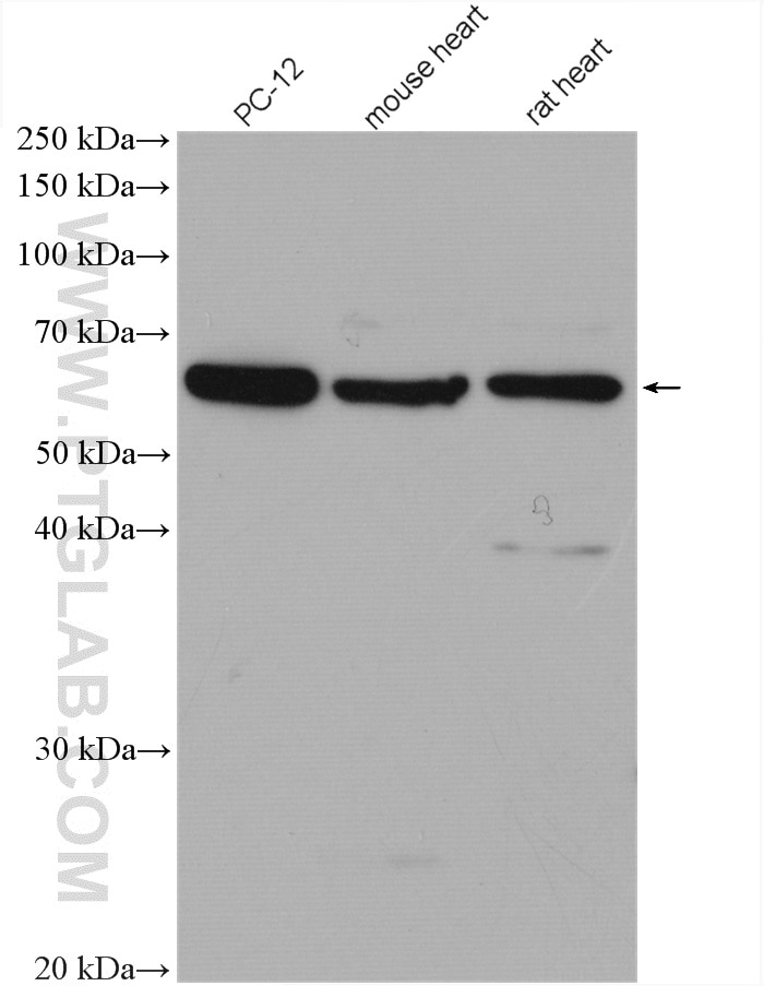 Western Blot (WB) analysis of various lysates using FOXO4 Polyclonal antibody (21535-1-AP)