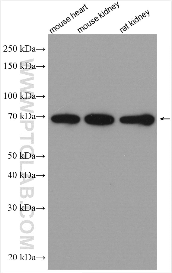 Western Blot (WB) analysis of various lysates using FOXO4 Polyclonal antibody (21535-1-AP)