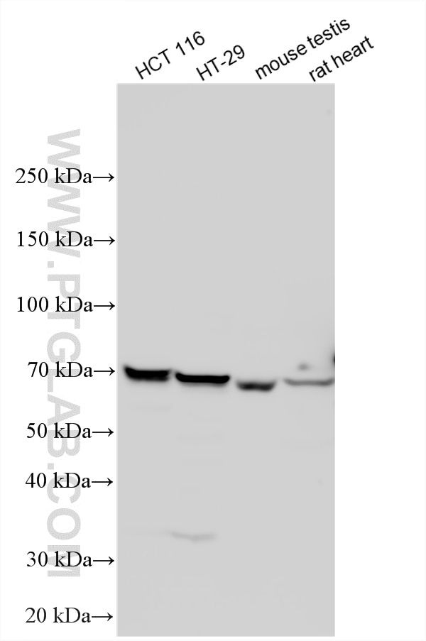 Western Blot (WB) analysis of various lysates using FOXO4 Polyclonal antibody (21535-1-AP)