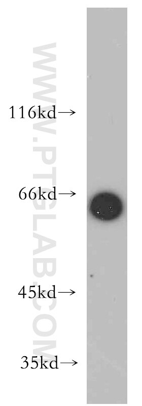 FOXO4 Polyclonal antibody