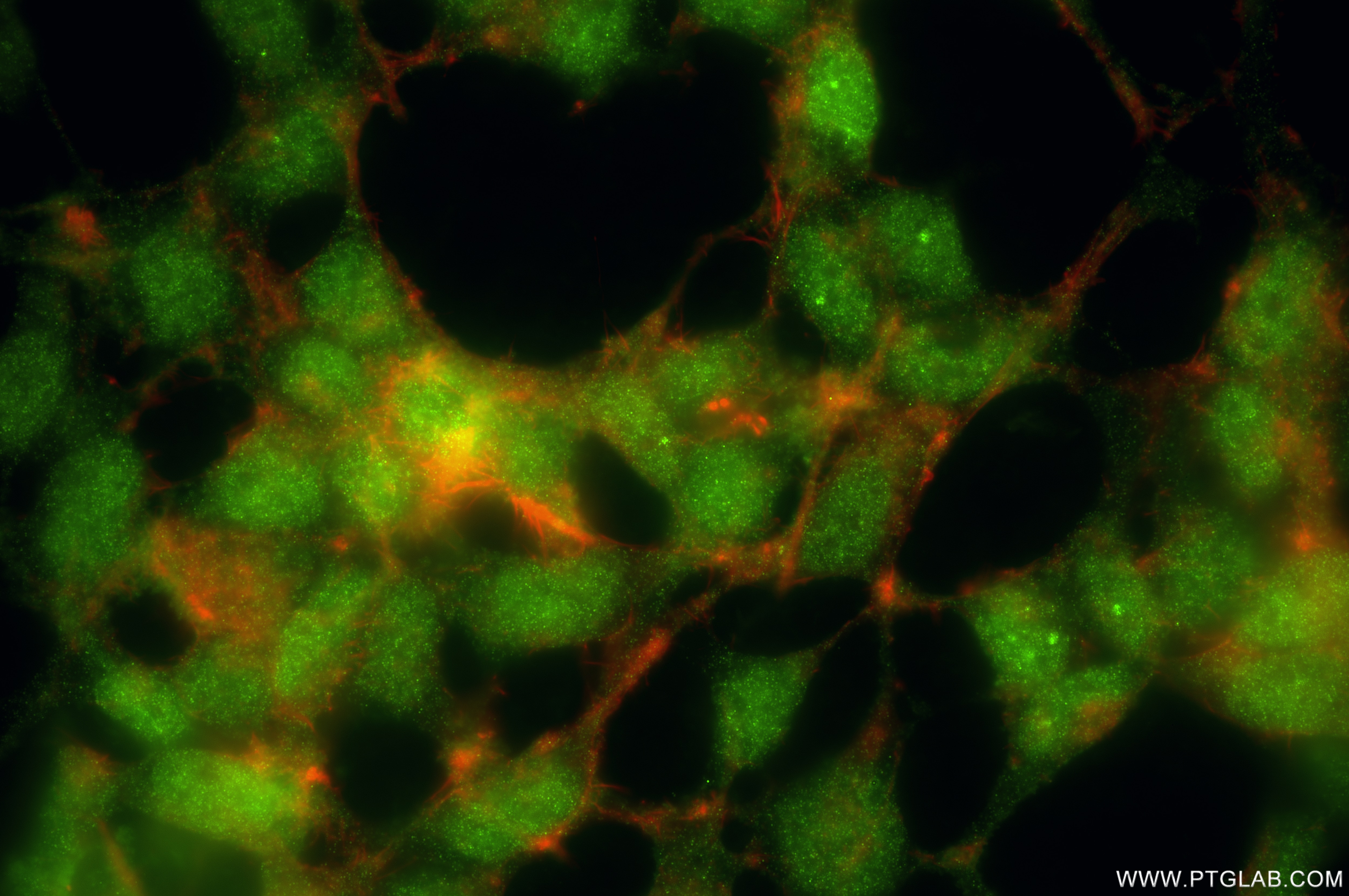Immunofluorescence (IF) / fluorescent staining of HEK-293T cells using FOXO4 Recombinant antibody (86236-1-RR)