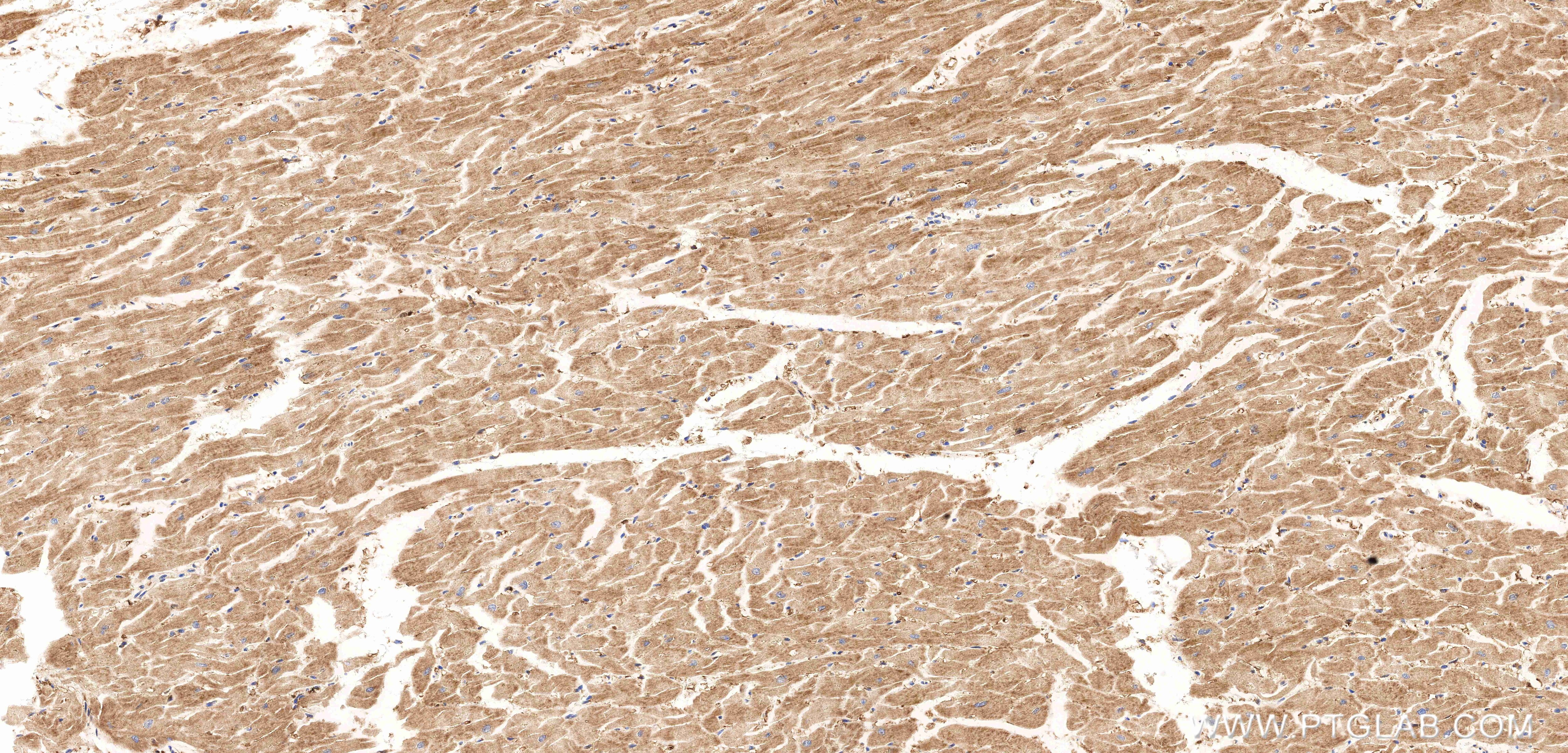 Immunohistochemical analysis of paraffin-embedded human heart tissue slide using 86236-1-RR (FOXO4 antibody) at dilution of 1:1000 (under 10x lens). Heat mediated antigen retrieval with Tris-EDTA buffer (pH 9.0). Immunohistochemistry (IHC) staining of human heart tissue using FOXO4 Recombinant monoclonal antibody (86236-1-RR)