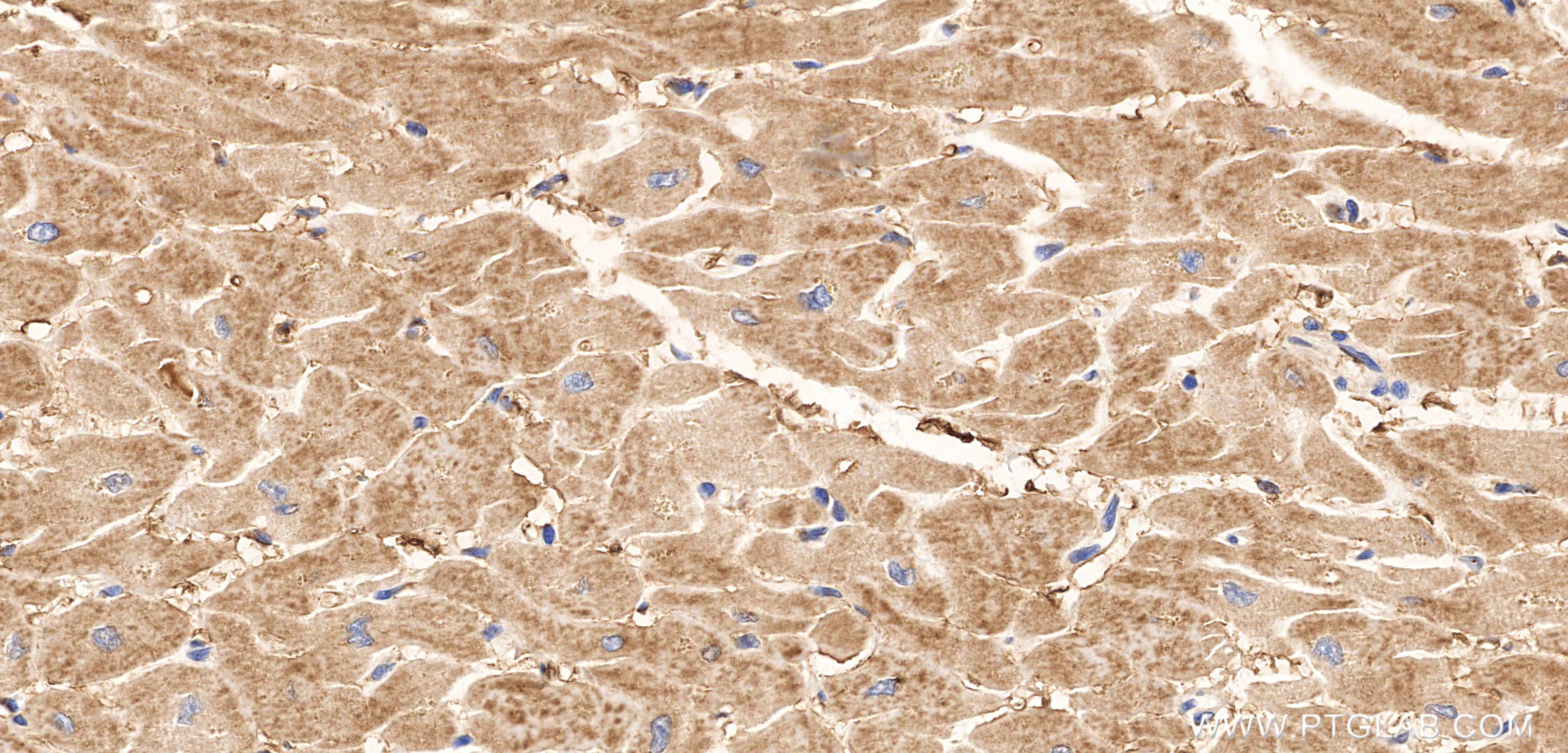 Immunohistochemical analysis of paraffin-embedded human heart tissue slide using 86236-1-RR (FOXO4 antibody) at dilution of 1:1000 (under 40x lens). Heat mediated antigen retrieval with Tris-EDTA buffer (pH 9.0). Immunohistochemistry (IHC) staining of human heart tissue using FOXO4 Recombinant monoclonal antibody (86236-1-RR)