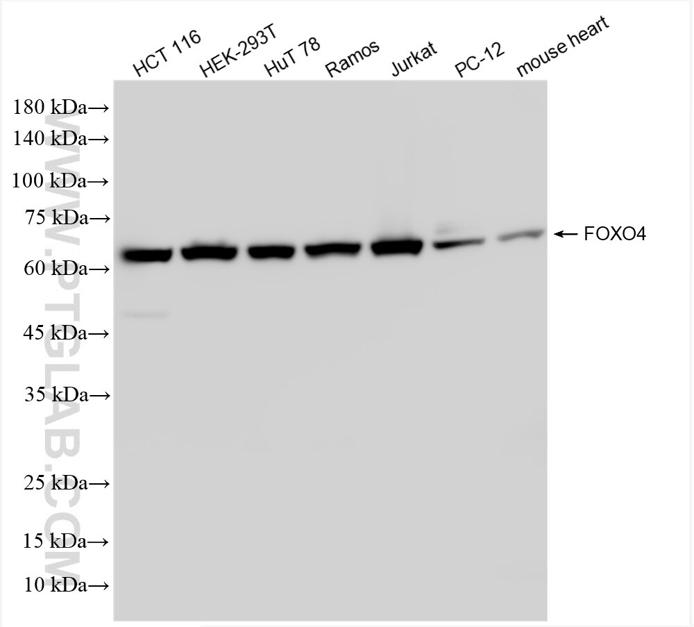 Western Blot (WB) analysis of various lysates using FOXO4 Recombinant antibody (86236-1-RR)