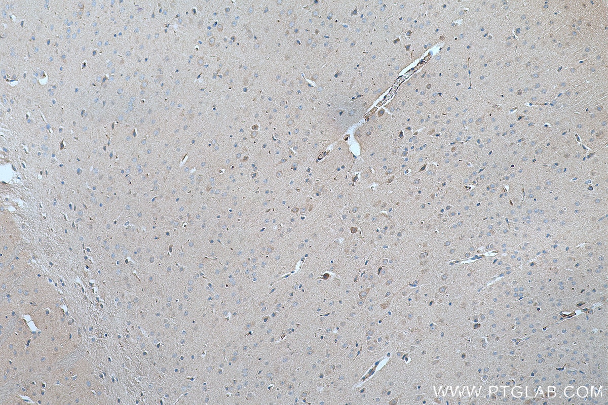 IHC staining of mouse brain using 19122-1-AP