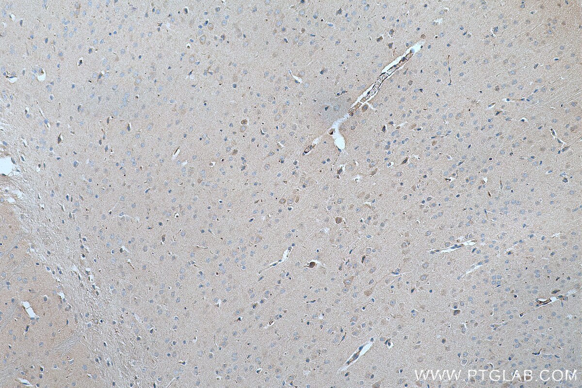 Immunohistochemistry (IHC) staining of mouse brain tissue using FOXO6 Polyclonal antibody (19122-1-AP)