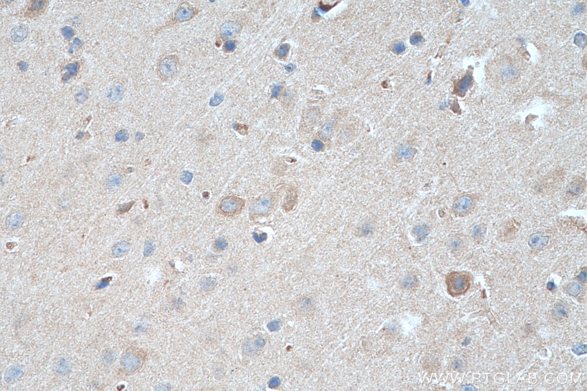 Immunohistochemistry (IHC) staining of mouse brain tissue using FOXO6 Polyclonal antibody (19122-1-AP)