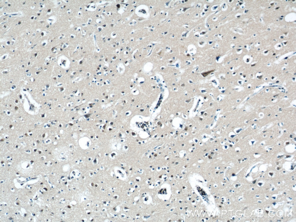 Immunohistochemistry (IHC) staining of human brain tissue using FOXO6 Polyclonal antibody (19122-1-AP)