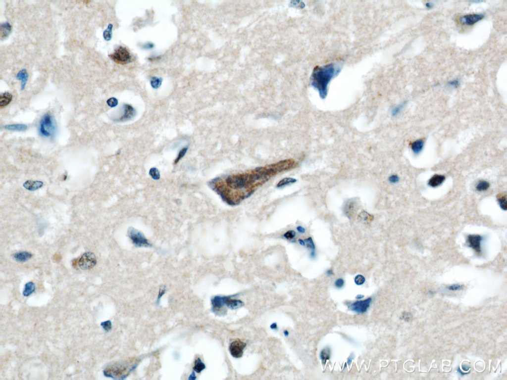 IHC staining of human brain using 19122-1-AP