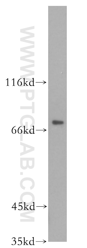 Western Blot (WB) analysis of mouse brain tissue using FOXO6 Polyclonal antibody (19122-1-AP)