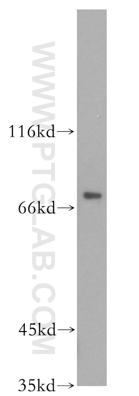 WB analysis of mouse brain using 19122-1-AP