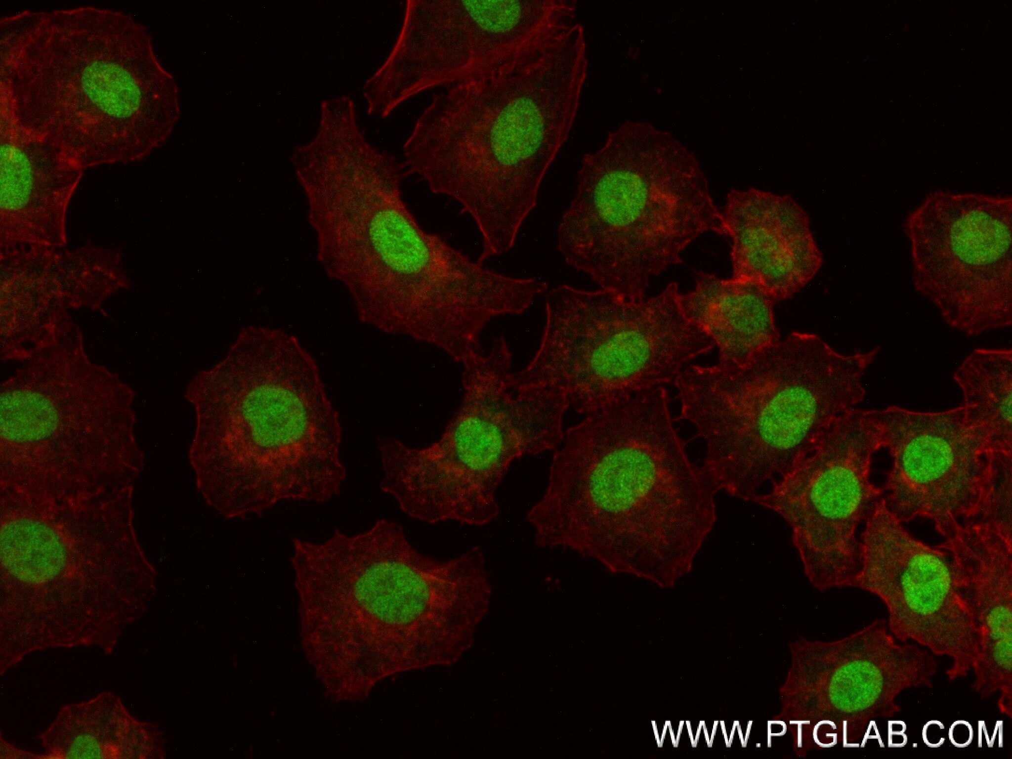 Immunofluorescence (IF) / fluorescent staining of A549 cells using FOXO6 Recombinant antibody (83926-1-RR)