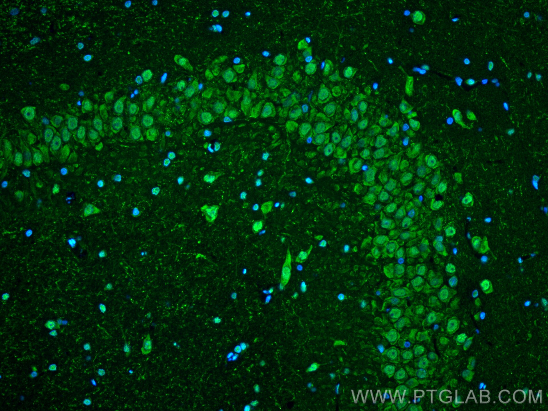 Immunofluorescence (IF) / fluorescent staining of rat brain tissue using FOXO6 Recombinant antibody (83926-1-RR)