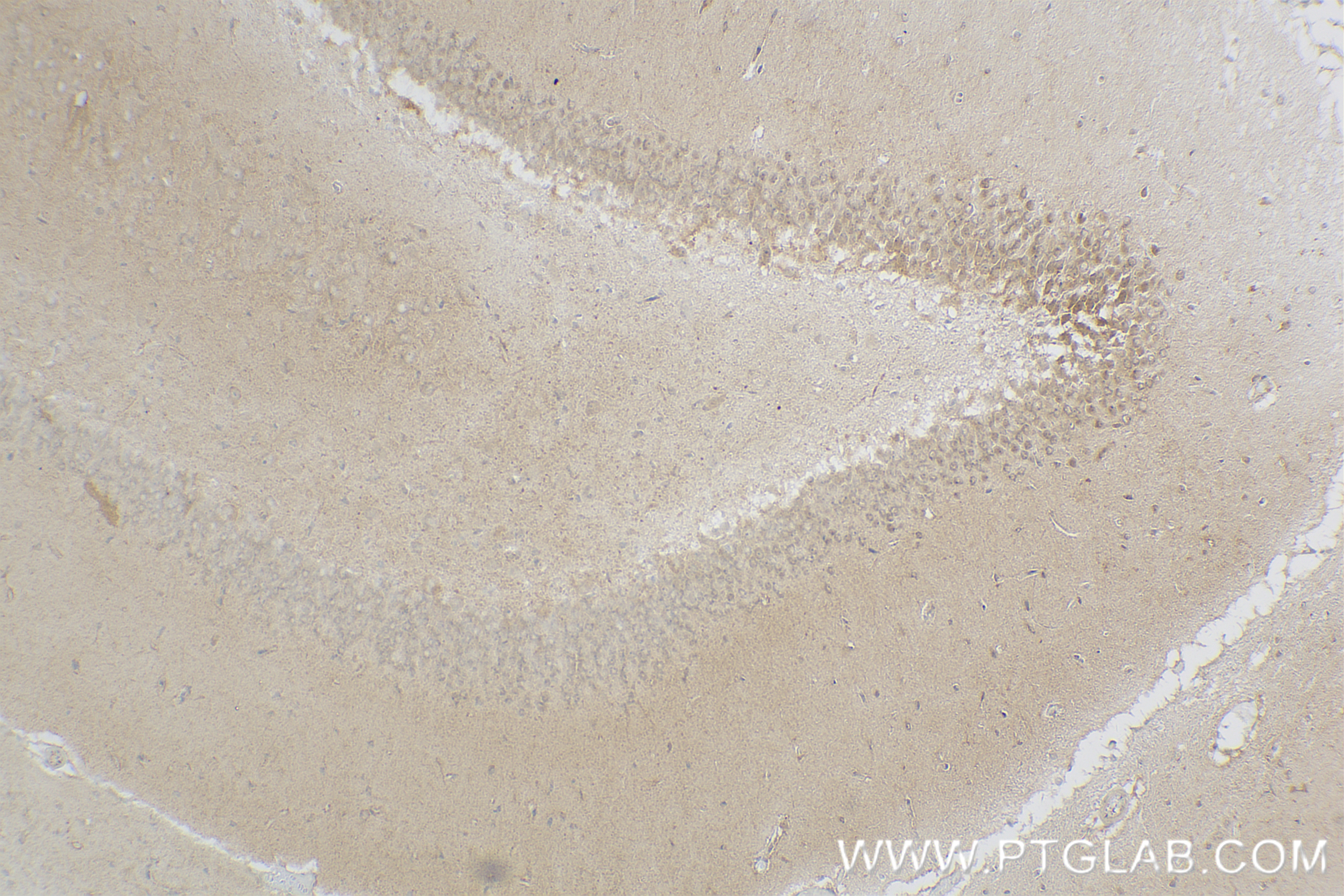 Immunohistochemistry (IHC) staining of rat brain tissue using FOXO6 Recombinant antibody (83926-1-RR)