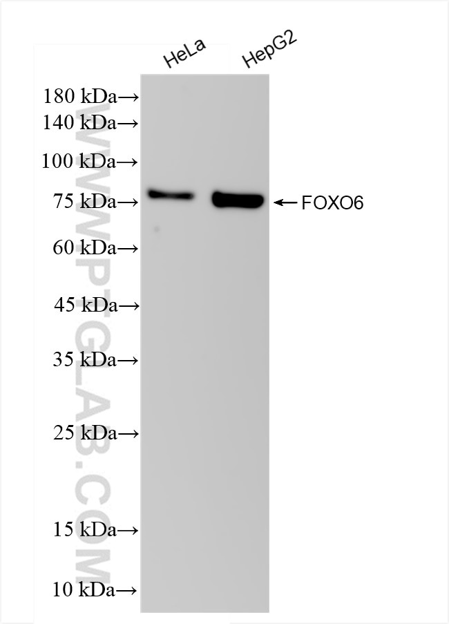 Western Blot (WB) analysis of various lysates using FOXO6 Recombinant antibody (83926-1-RR)
