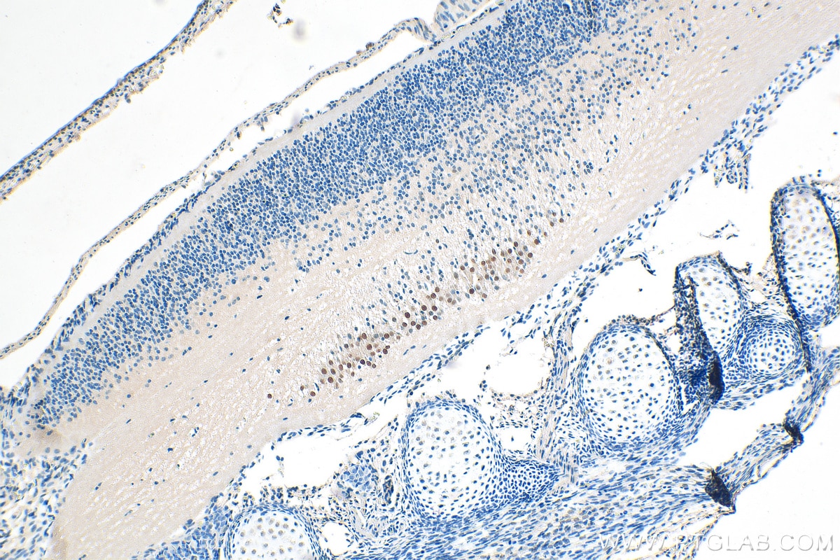 Immunohistochemistry (IHC) staining of mouse embryo tissue using FOXP1 Polyclonal antibody (22051-1-AP)
