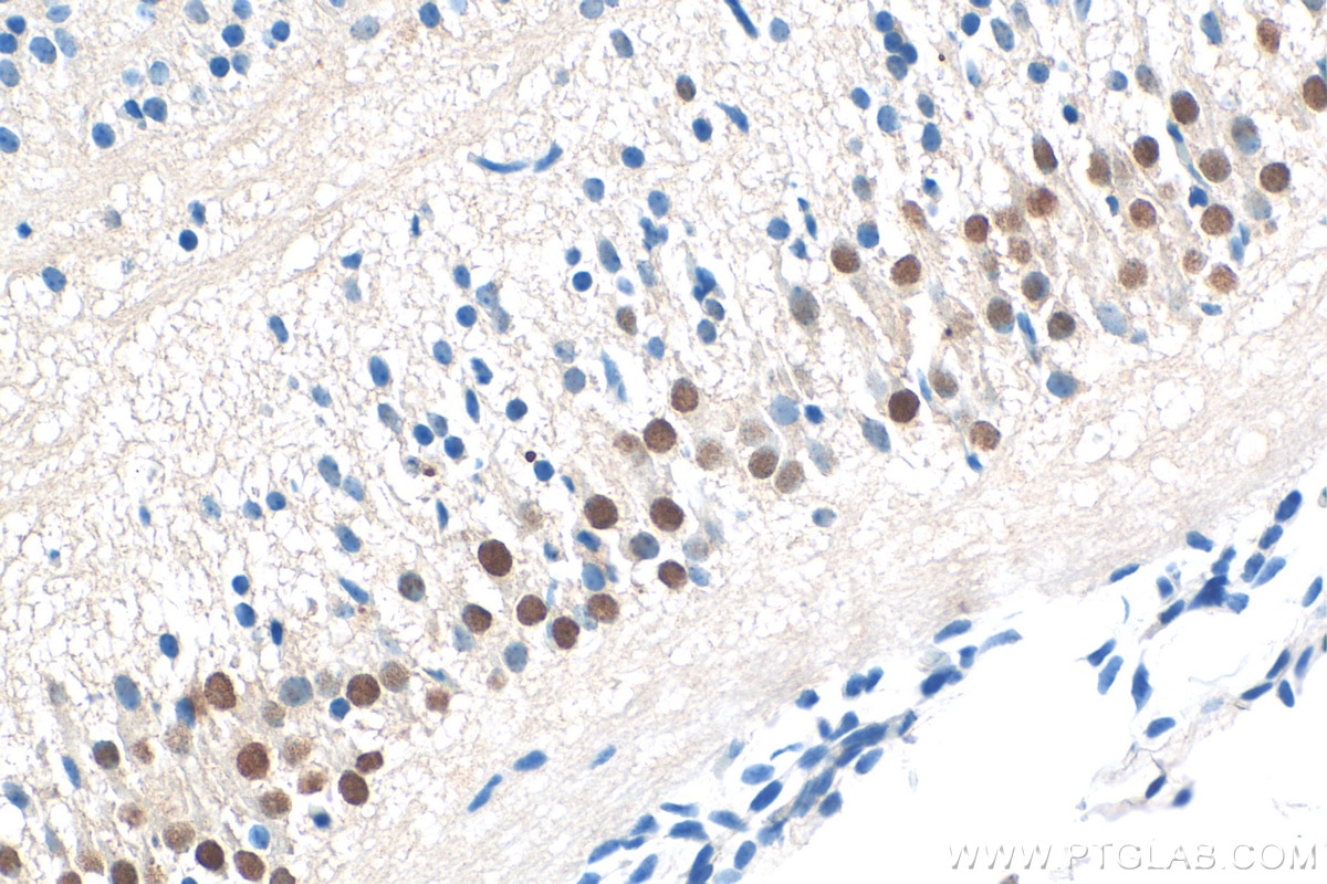 Immunohistochemistry (IHC) staining of mouse embryo tissue using FOXP1 Polyclonal antibody (22051-1-AP)