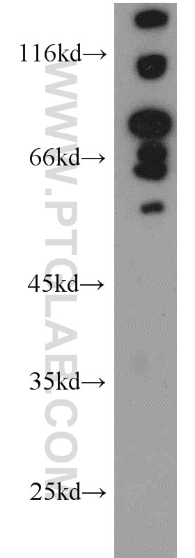 Western Blot (WB) analysis of MCF-7 cells using FOXP1 Polyclonal antibody (22051-1-AP)