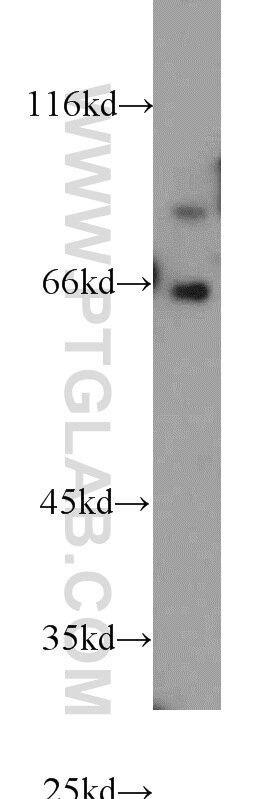 Western Blot (WB) analysis of mouse heart tissue using FOXP1 Polyclonal antibody (22051-1-AP)