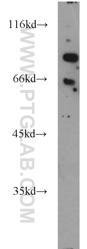 Western Blot (WB) analysis of Jurkat cells using FOXP1 Polyclonal antibody (22051-1-AP)