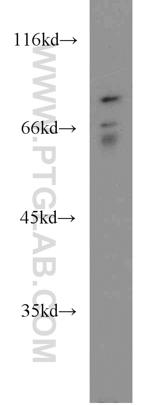 WB analysis of A549 using 22051-1-AP