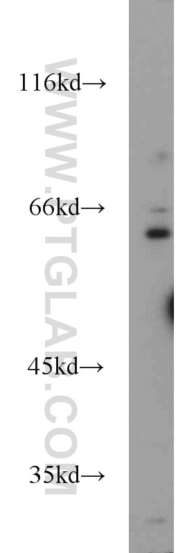 Western Blot (WB) analysis of mouse testis tissue using FOXP1 Polyclonal antibody (22051-1-AP)