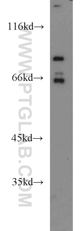 Western Blot (WB) analysis of PC-3 cells using FOXP1 Polyclonal antibody (22051-1-AP)