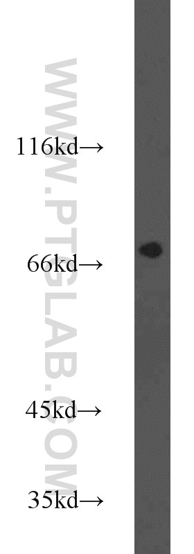 Western Blot (WB) analysis of Y79 cells using FOXP1 Polyclonal antibody (22051-1-AP)