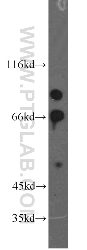 Western Blot (WB) analysis of mouse lung tissue using FOXP1 Polyclonal antibody (22051-1-AP)