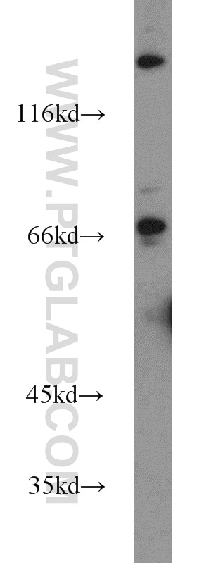 Western Blot (WB) analysis of Raji cells using FOXP1 Polyclonal antibody (22051-1-AP)