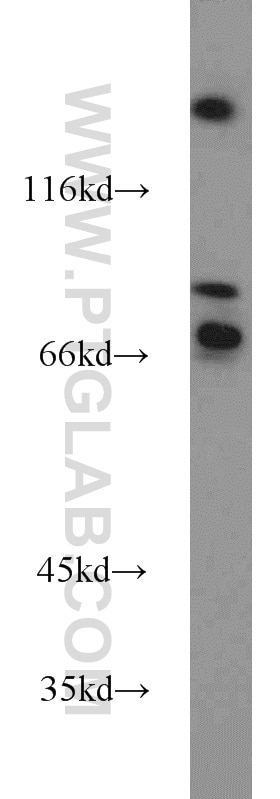 Western Blot (WB) analysis of LNCaP cells using FOXP1 Polyclonal antibody (22051-1-AP)