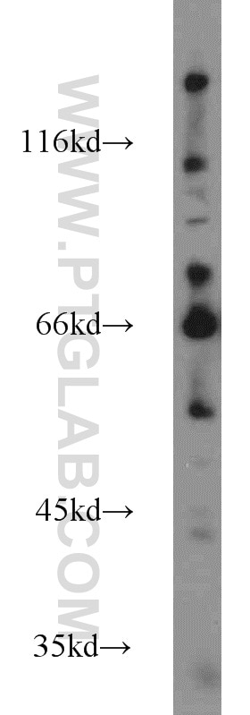 Western Blot (WB) analysis of MDA-MB-453s cells using FOXP1 Polyclonal antibody (22051-1-AP)