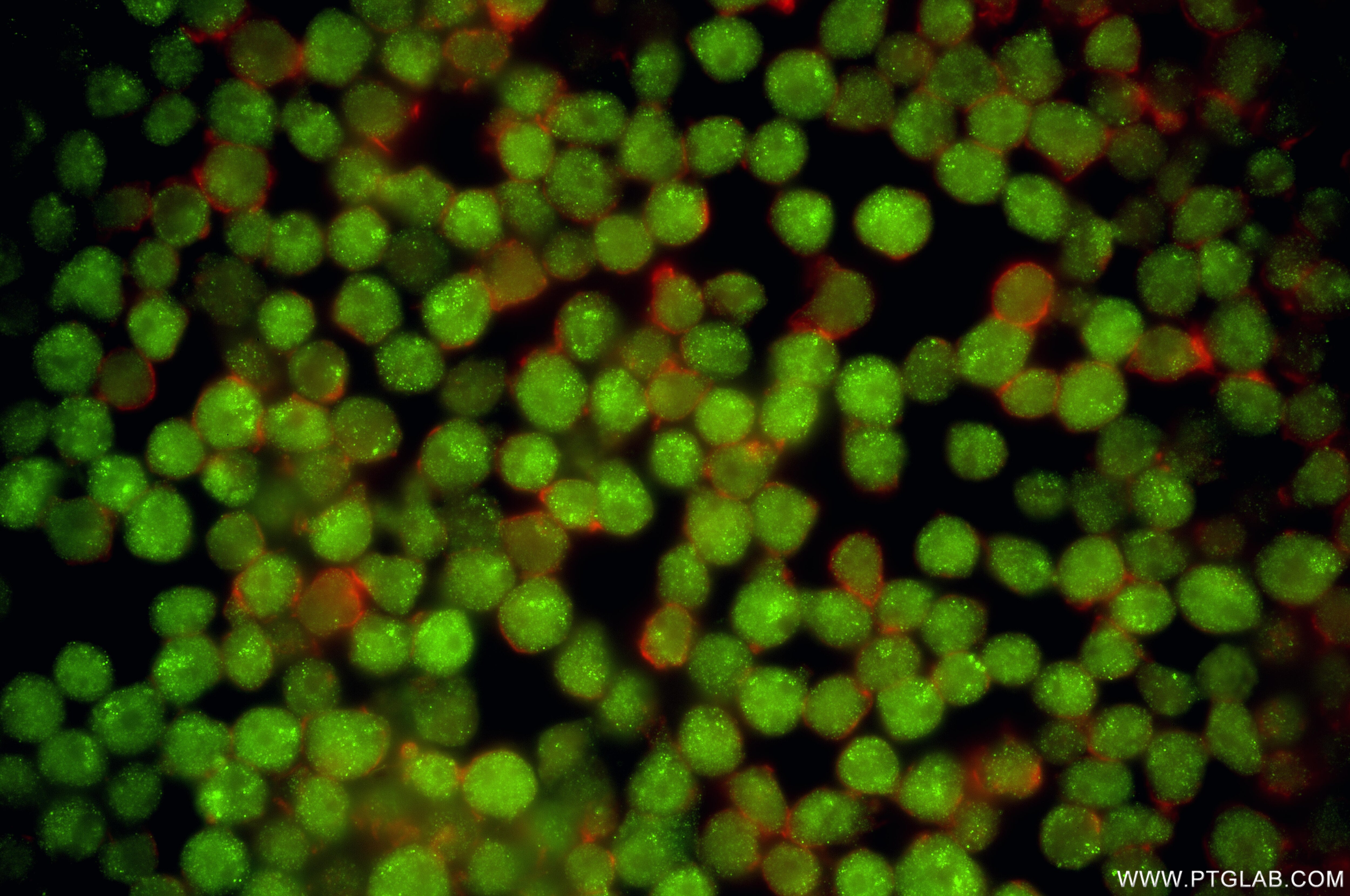 Immunofluorescence (IF) / fluorescent staining of Jurkat cells using FOXP1 Recombinant monoclonal antibody (86937-1-RR)