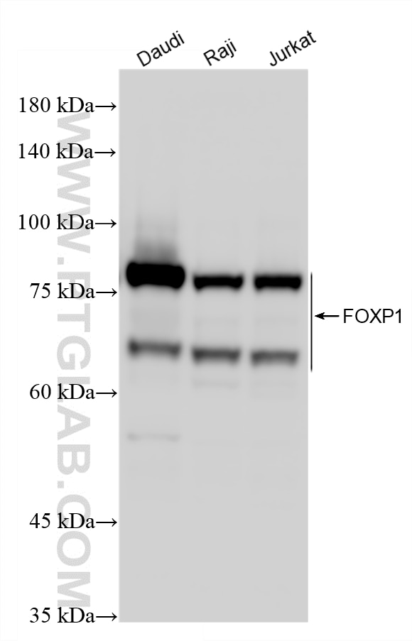 Western Blot (WB) analysis of various lysates using FOXP1 Recombinant monoclonal antibody (86937-1-RR)