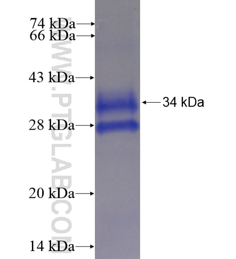FOXP1 fusion protein Ag13402 SDS-PAGE