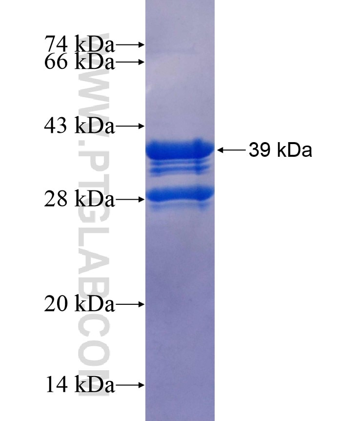 FOXP1 fusion protein Ag17045 SDS-PAGE