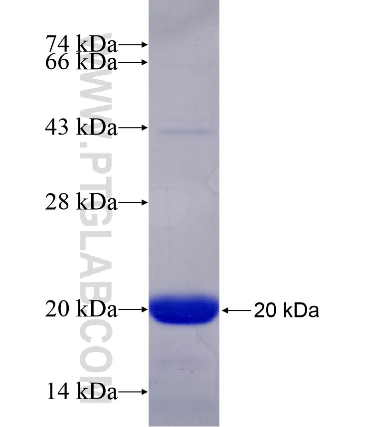 FOXP1 fusion protein Ag17463 SDS-PAGE
