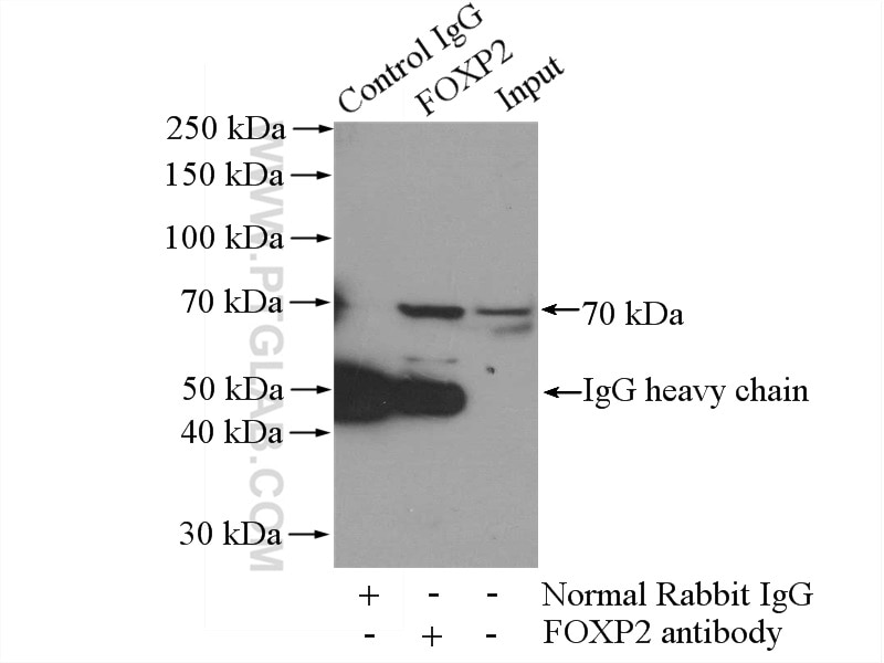 Immunoprecipitation (IP) experiment of mouse spleen tissue using FOXP2 Polyclonal antibody (20529-1-AP)