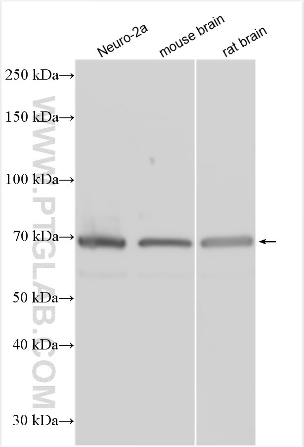 Western Blot (WB) analysis of various lysates using FOXP2 Polyclonal antibody (20529-1-AP)