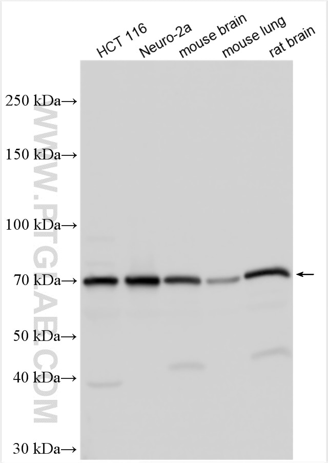 Western Blot (WB) analysis of various lysates using FOXP2 Polyclonal antibody (20529-1-AP)