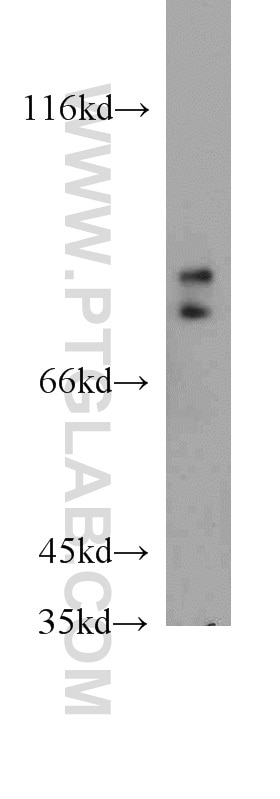 Western Blot (WB) analysis of HEK-293 cells using FOXP2 Polyclonal antibody (20529-1-AP)