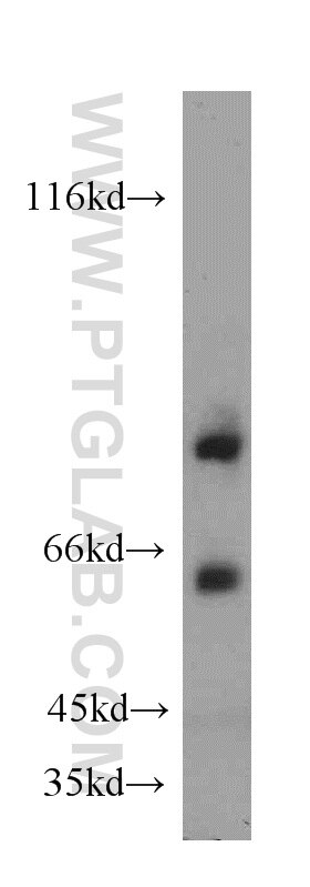 Western Blot (WB) analysis of mouse spleen tissue using FOXP2 Polyclonal antibody (20529-1-AP)