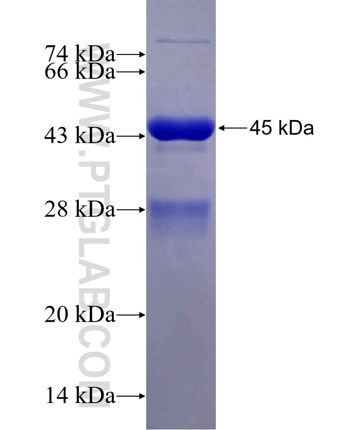FOXP2 fusion protein Ag29791 SDS-PAGE