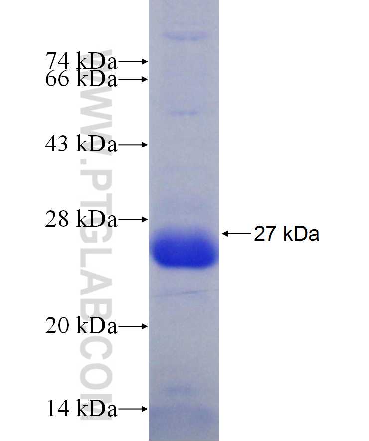 FOXP2 fusion protein Ag29855 SDS-PAGE