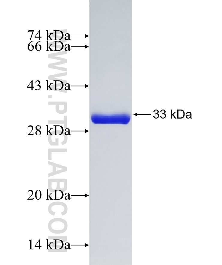 FOXP2 fusion protein Ag14391 SDS-PAGE